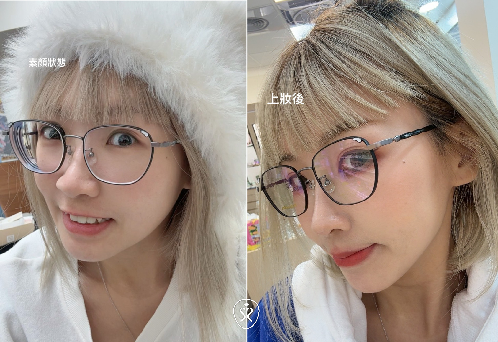 不用害怕年齡帶來的歲月痕跡，透過醫美療程，擁有更多選擇權，更緊緻更有神采的樣貌